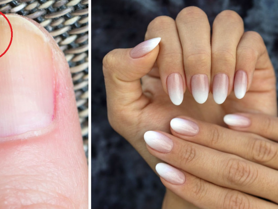 Las uñas dicen mucho de lo que le pasa a tu salud advierte un dermatólogo