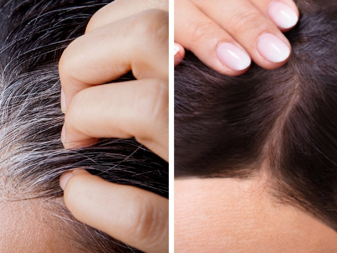 Por qué aparecen las canas antes de los 30? 4 trucos efectivos para  cubrirlas sin dañar tu hermoso cabello