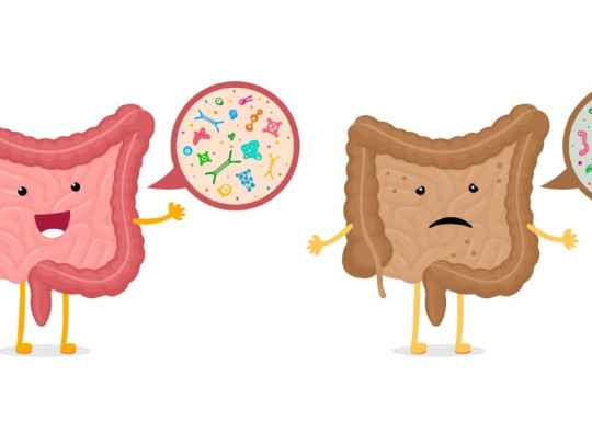Dibujo de un intestino limpio vs un intestino sucio.