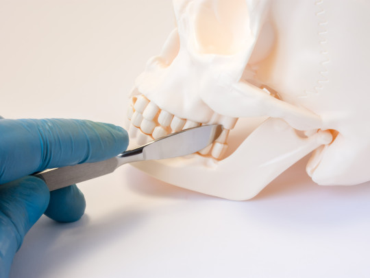 Maqueta de cráneo para explicar sobre la cirugía maxilofacial: Qué es y para qué se hace