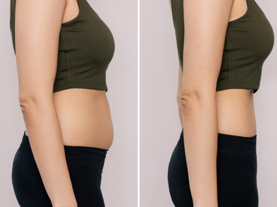 Mujer pierde peso antes y después