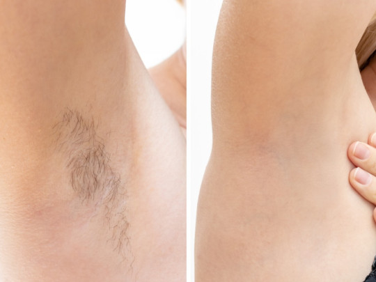 Mujer observa el antes y después de depilarse con bicarbonato las axilas