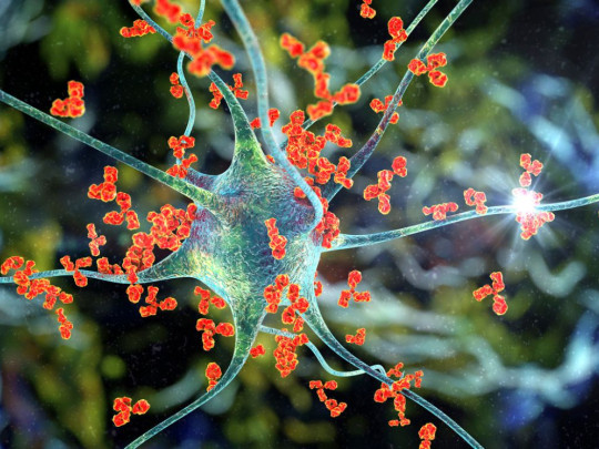 Ilustración de neurona para explicar si el Alzheimer se contagia y los 5 casos que explicarían cómo