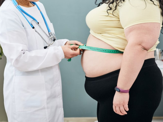 Mujer con obesidad es medida por médico