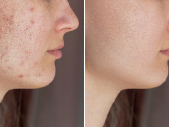 Mujer con manchas en la piel antes y después
