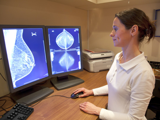 Investigadora revisa mamografía de paciente con cáncer de mama