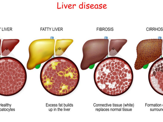Ilustración de hígado