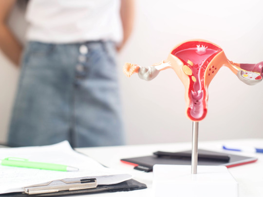 Maqueta de útero frente a persona para ilustrar el Ovario poliquístico: Donde acumulas grasa podría delatarlo