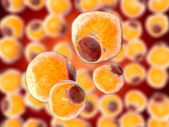 Células de grasa cómo son los tumores por cáncer de grasa