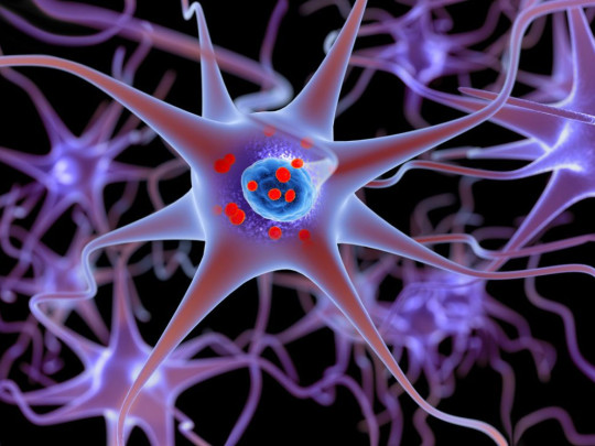 Ilustración de neurona para explicar si el Alzheimer se puede contagiar, 5 casos explicarían cómo