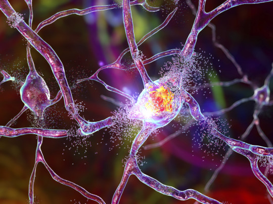 Neuronas cerebrales descubren posible causa del Parkinson