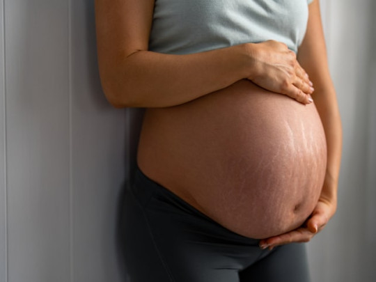 Mujer embarazada con estrías en vientre