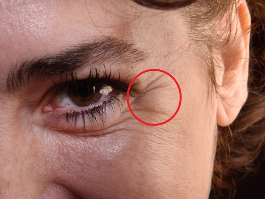 Mujer con arrugas marcadas en los ojos