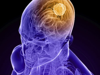 La progesterona regula el crecimiento de tumores