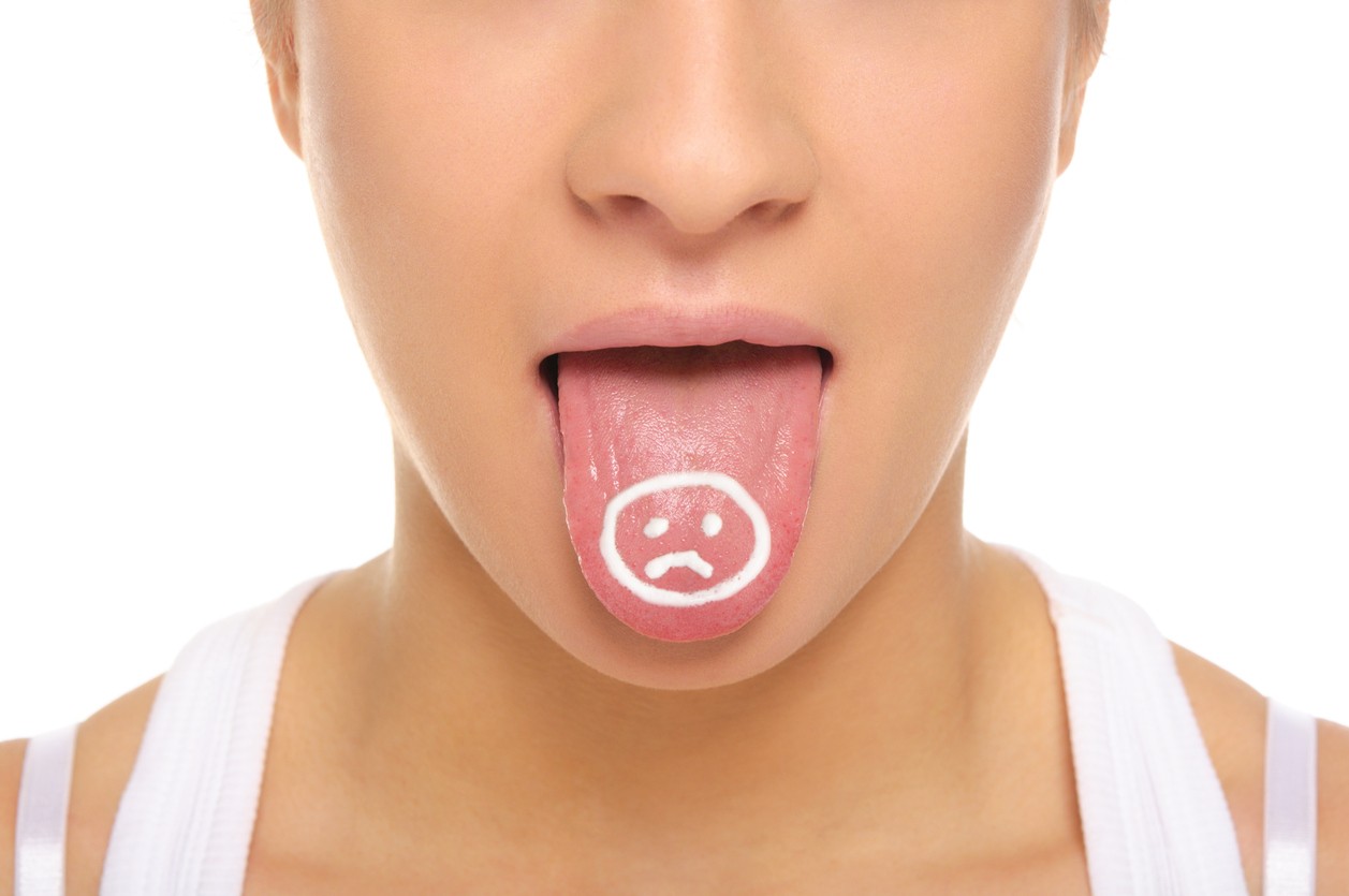Amabilidad Hambre montículo Cómo curar las aftas en la lengua