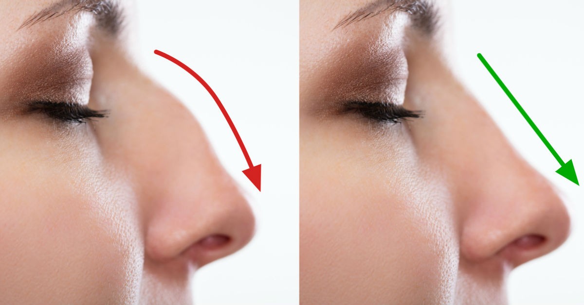 Funciona la famosa técnica para afilar la nariz sin cirugía?