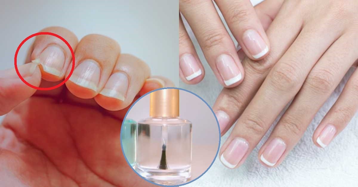 Cómo usar ajo para fortalecer tus uñas Remedios y consejos  CHIC Magazine