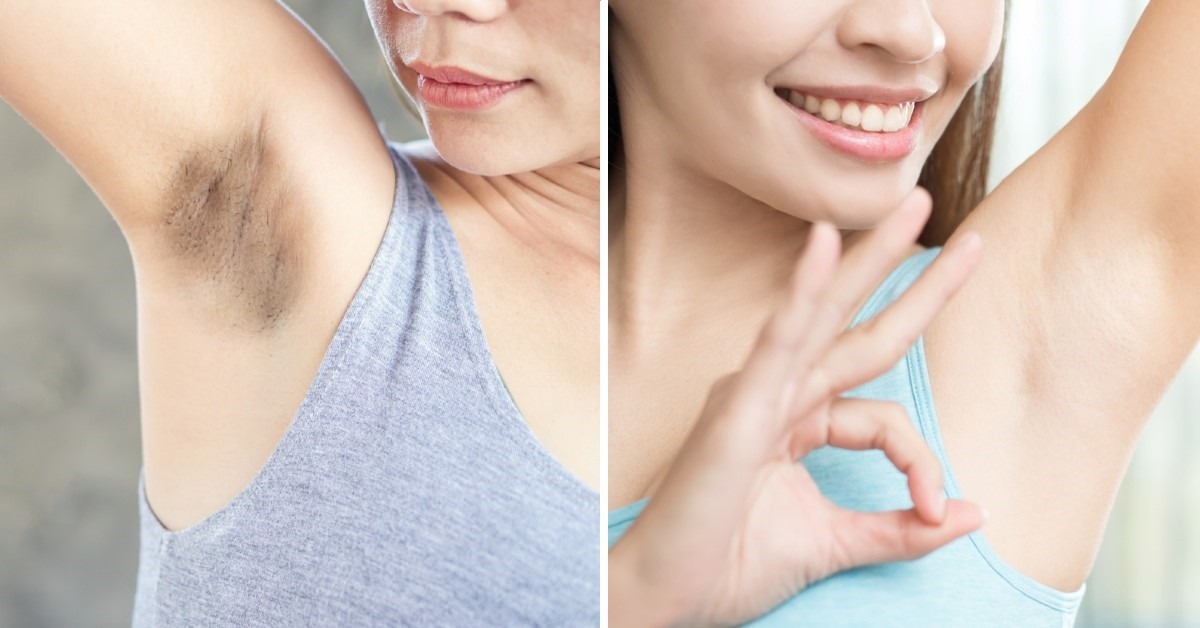 qué manchan las axilas? trucos efectivos aclararlas sin irritar tu piel