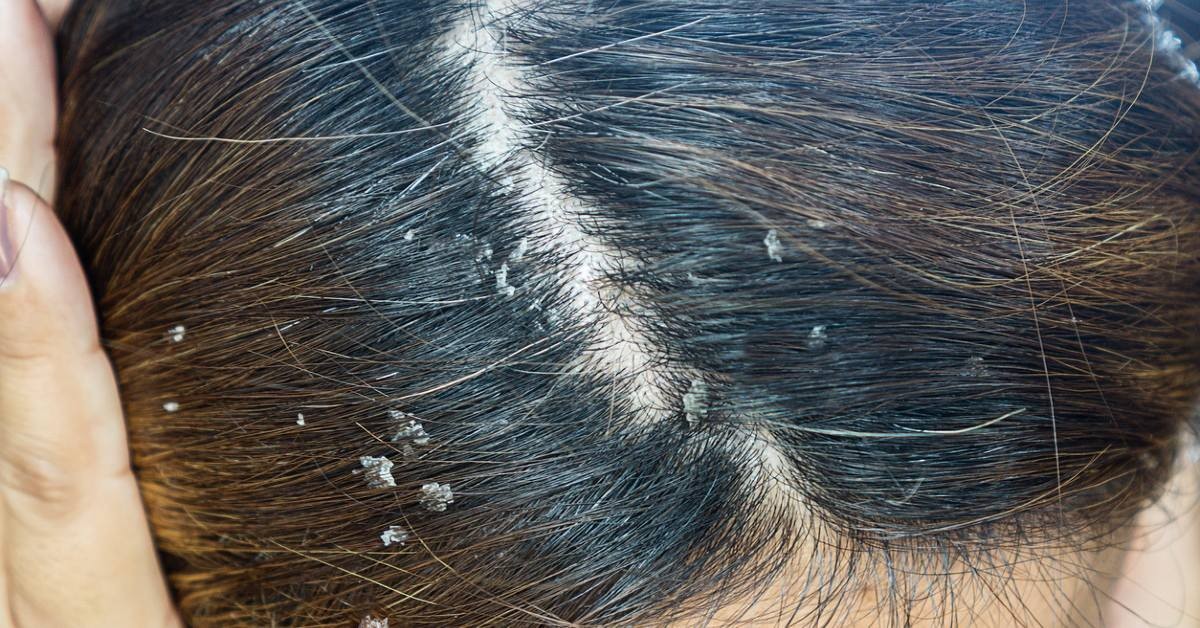 Entretener imitar Ejecutante Tu cabello huele a grasita? 4 remedios para eliminar el mal olor de pelo