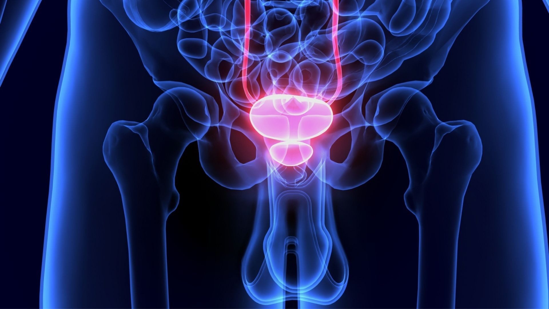 Cancer de prostata: cea de-a patra cauză de deces în rândul bărbaților