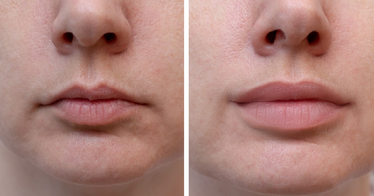 Luce unos labios más carnosos sin botox: 4 de maquillaje que aportan volumen