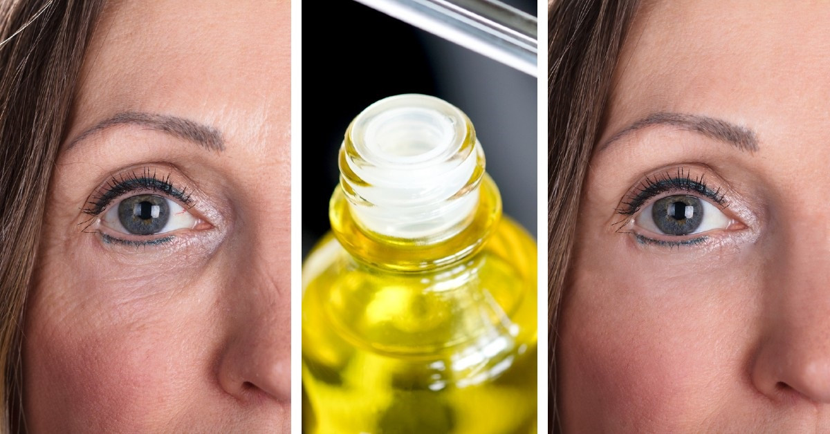 Cómo usar vitamina E en la cara para tener una piel suave, hermosa y rejuvenecida