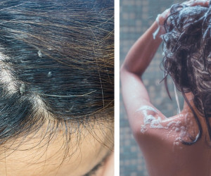Qué son los shampoos clarificantes: 2 razones para usarlos si tu cuero cabelludo es graso