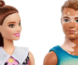 Sí a la inclusión: lanzan Barbie con aparato auditivo y Ken con vitiligo