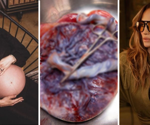 Por qué se comen la placenta: 7 famosas que lo hicieron después de dar a luz, ¿es seguro?