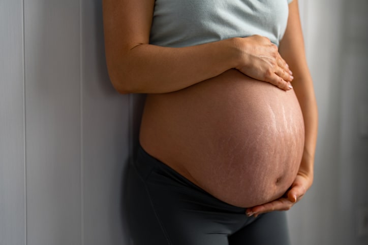 Mujer embarazada con estrías en vientre