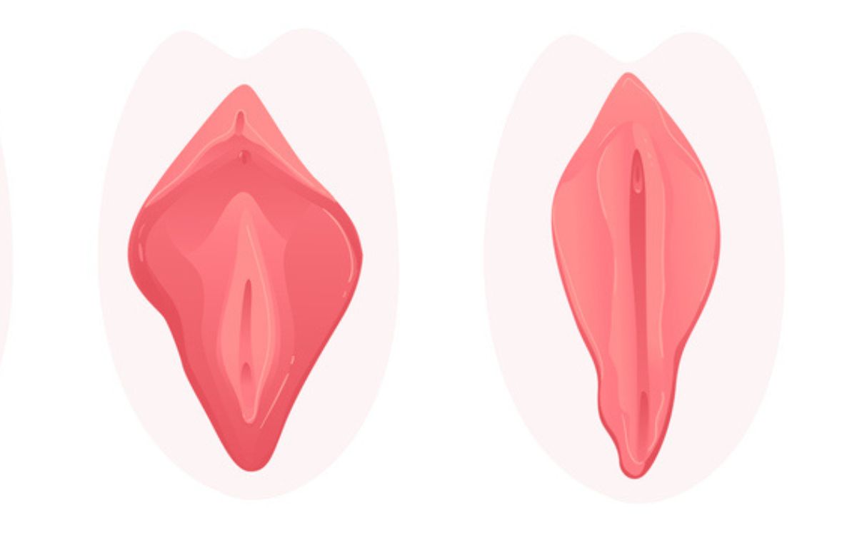 Ilustración que hace referencia a los tipos de vagina